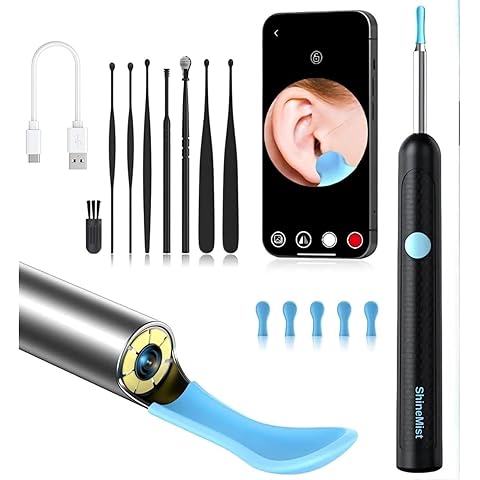 ShopTrend™ Smart Visual Ear-Wax Remover Kit with 1080P HD Endoscope Camera, 8-Piece Safety Cleaning Set – Visual Otoscope for Adults & Kids – Washable / Reusable