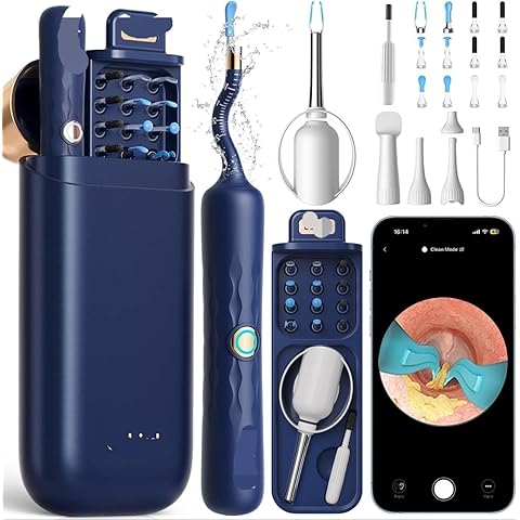 ShopTrend™ Smart Visual Ear-Wax Remover Kit with 1080P HD Endoscope Camera, 8-Piece Safety Cleaning Set – Visual Otoscope for Adults & Kids – Washable / Reusable