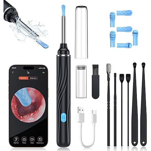 ShopTrend™ Smart Visual Ear-Wax Remover Kit with 1080P HD Endoscope Camera, 8-Piece Safety Cleaning Set – Visual Otoscope for Adults & Kids – Washable / Reusable