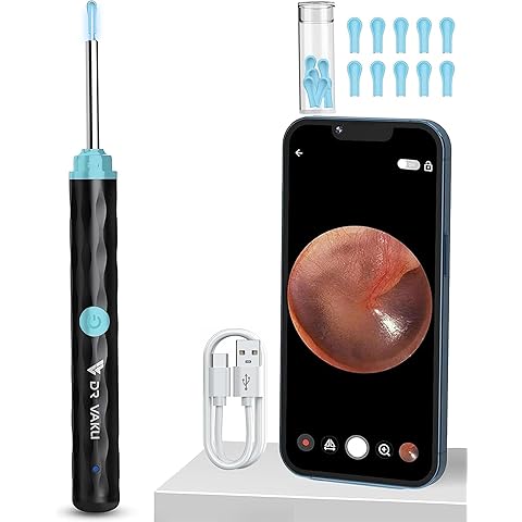 ShopTrend™ Smart Visual Ear-Wax Remover Kit with 1080P HD Endoscope Camera, 8-Piece Safety Cleaning Set – Visual Otoscope for Adults & Kids – Washable / Reusable